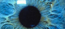 Iridology