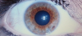 Iridology Scan